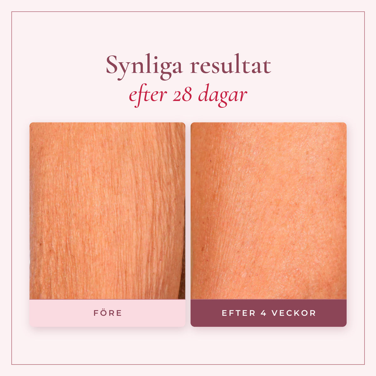 Synliga resultat på 28 dagar med Champagne Beauté Lift