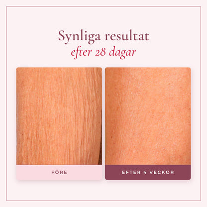 Synliga resultat på 28 dagar med Champagne Beauté Lift